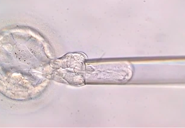 Diagnóstico Genético Preimplantacional del Embrión (DGP)
