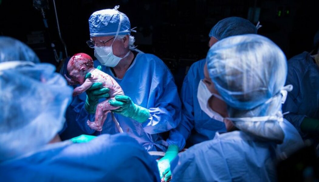 Nace el primer bebé de EE.UU. de un útero trasplantado
