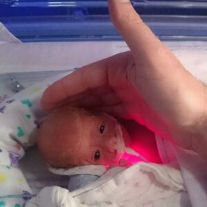 Un médico salva la vida a un bebé prematuro de solo 28 semanas al envolverlo en una bolsa de bocadillos.