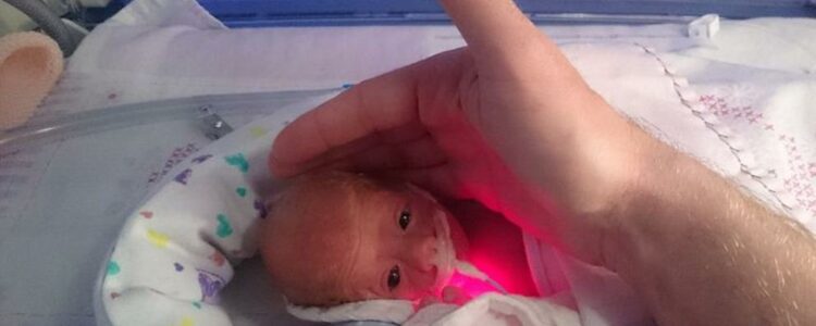 Un médico salva la vida a un bebé prematuro de solo 28 semanas al envolverlo en una bolsa de bocadillos.