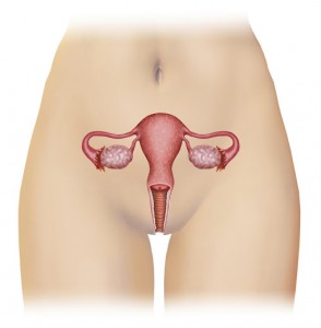 ¿Qué és la Endometriosis?