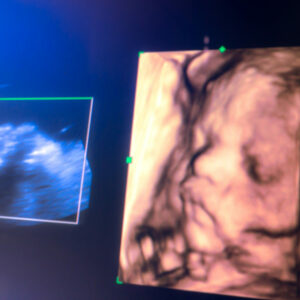 A los fetos les gusta más la música clásica, según estudio clínica Barcelona