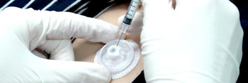 Adiós a los pinchazos en los tratamientos de fertilidad