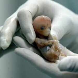 Alertan por aumento de embriones humanos congelados Alertan por aumento de embriones humanos congelados