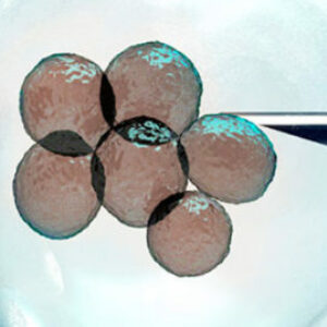 Biopsia del embrión para DGP