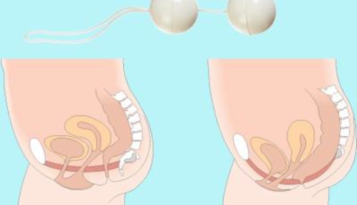 Bolas chinas: ¿buenas para recuperar el suelo pélvico?
