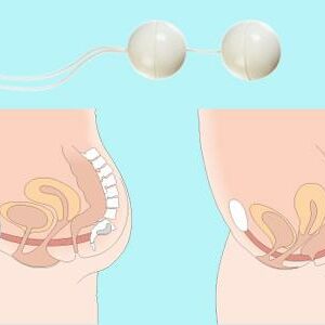 Bolas chinas: ¿buenas para recuperar el suelo pélvico?