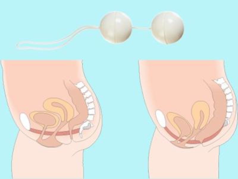 Bolas chinas: ¿buenas para recuperar el suelo pélvico?