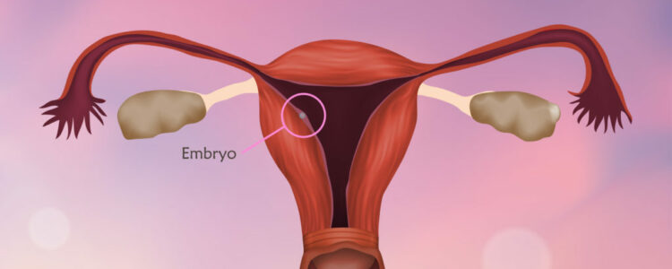 ¿Cómo mejorar la implantación embrionaria en el tratamiento de fertilidad?