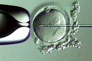 ¿Conoces la técnica de fecundación in vitro (FIV) con microinyección espermática?