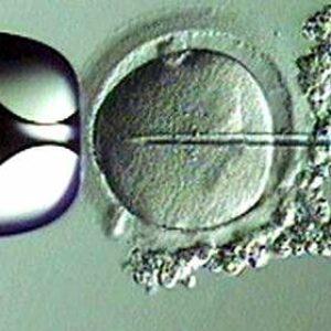 ¿Conoces la técnica de fecundación in vitro (FIV) con microinyección espermática?