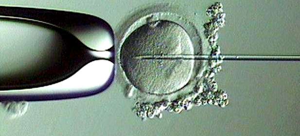 ¿Conoces la técnica de fecundación in vitro (FIV) con microinyección espermática?