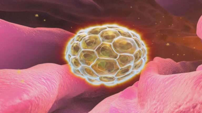 ¿Cuáles son los síntomas de la implantación embrionaria?