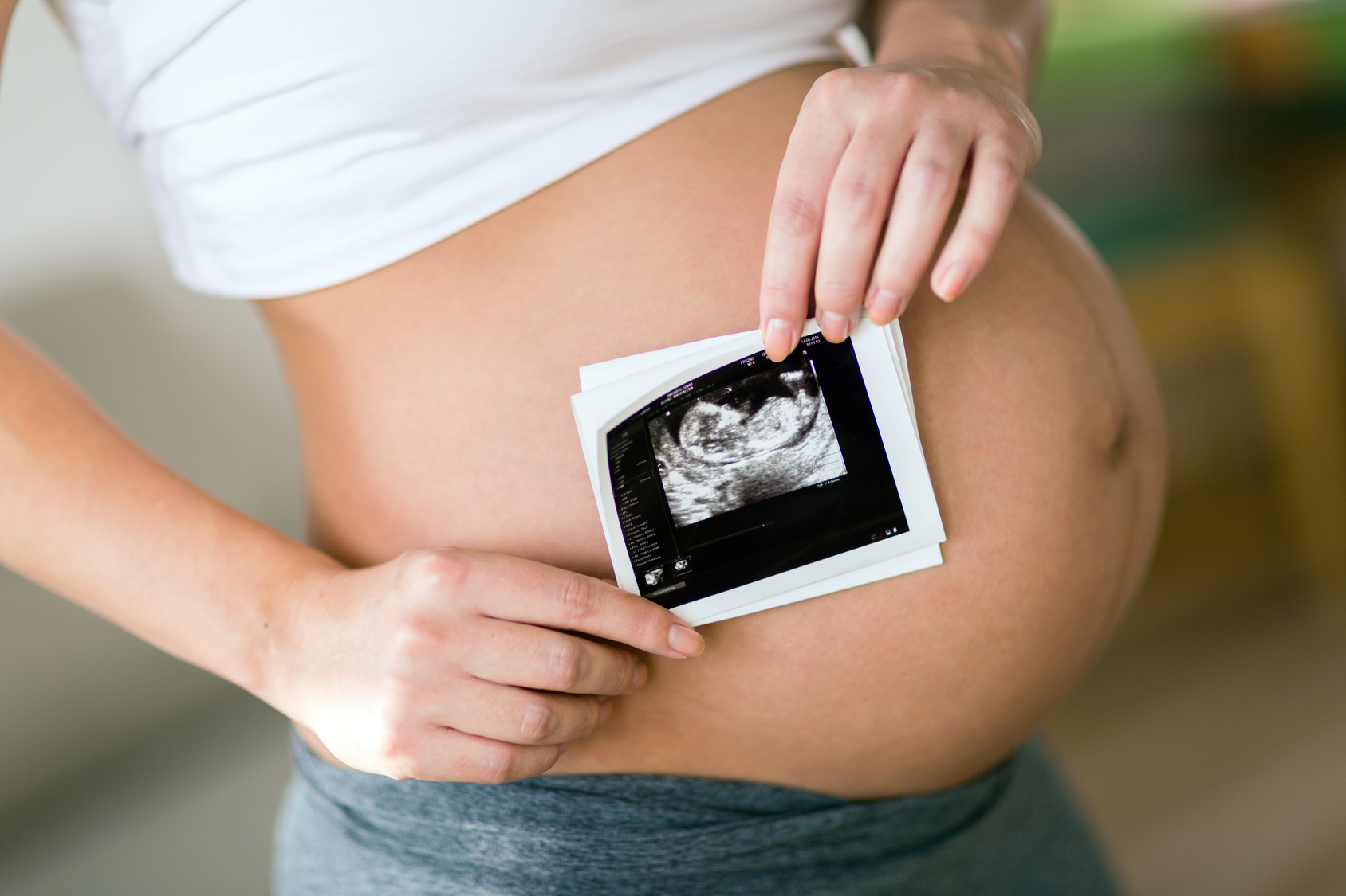 ¿Es posible el embarazo tras una ruptura uterina?