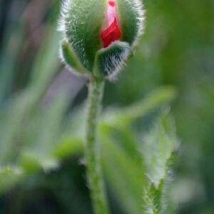 ¿La acupuntura aumenta el éxito en la fertilización in vitro?
