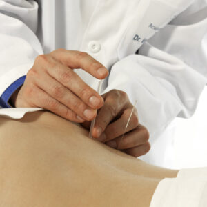 ¿La acupuntura disminuye la ansiedad antes de una FIV?