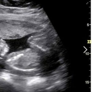 ¿Por qué no deberías preguntarle a la gente cuándo piensa tener hijos? Esta mujer da en el clavo