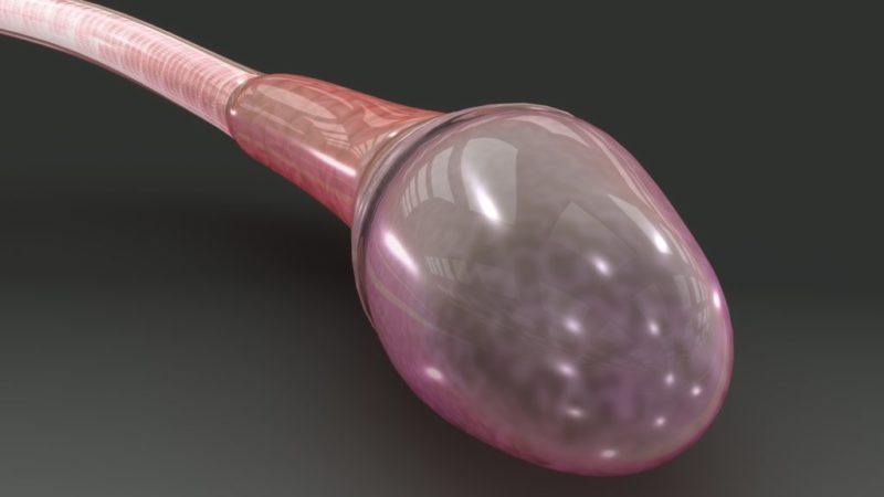 ¿Por qué un espermatozoide triunfa y los demás no?