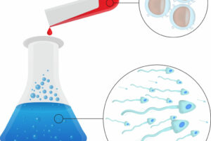 ¿Qué es el DGP (Diagnóstico Genético Preimplantacional)?