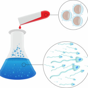 ¿Qué es el DGP (Diagnóstico Genético Preimplantacional)?