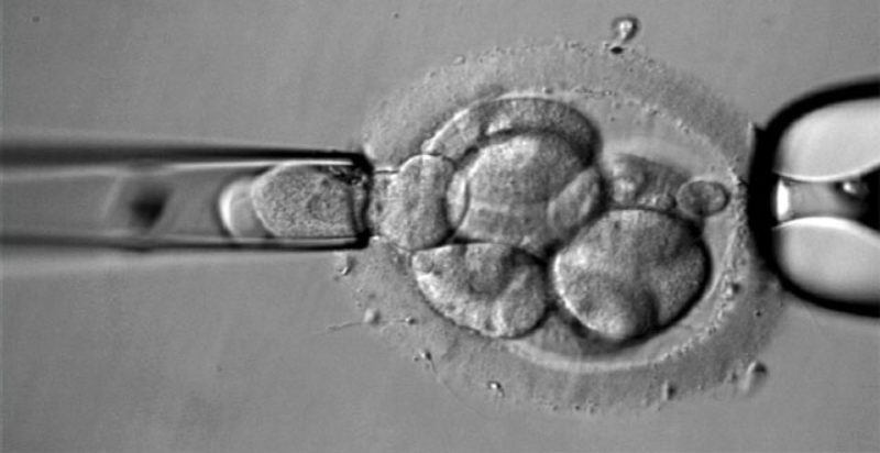 ¿Qué es la zona pelúcida? ¿Qué importancia tiene para la reproducción asistida?