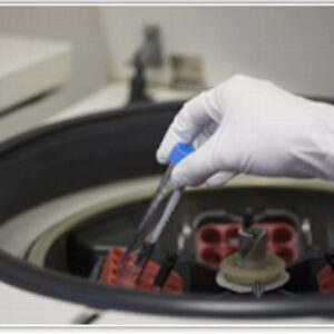 ¿Qué es un Banco de Semen?