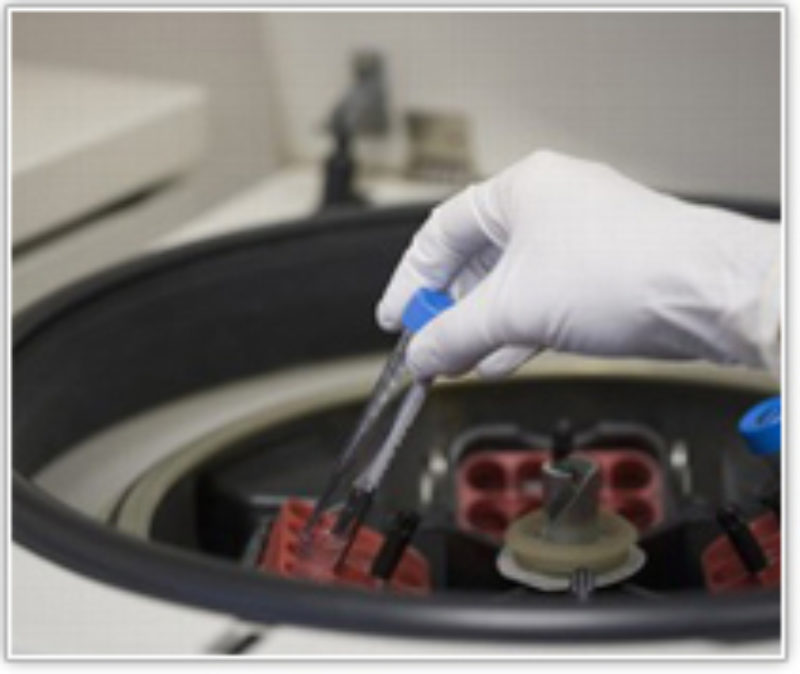 ¿Qué es un Banco de Semen?