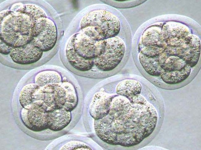 ¿Transferir uno o dos embriones?