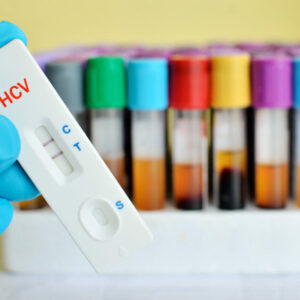 Cómo preparamos a una donante de óvulos en URE Centro Gutenberg