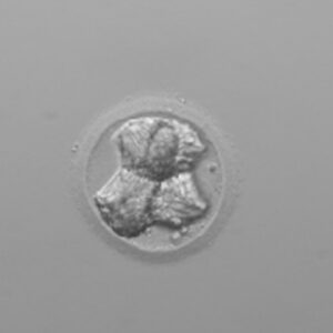 Cómo preservar la fertilidad