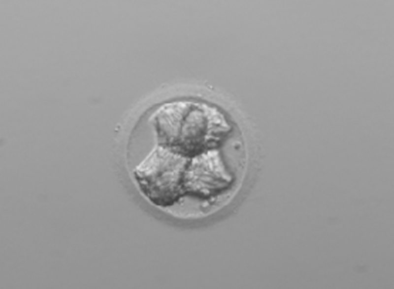 Cómo preservar la fertilidad