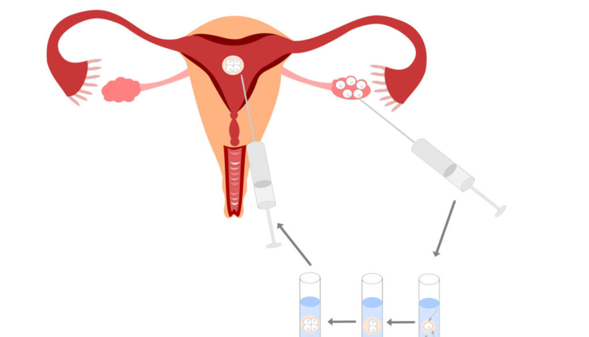 Como mejorar el grosor del endometrio