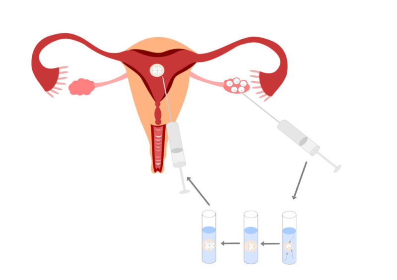 Como mejorar el grosor del endometrio