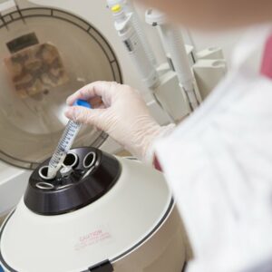 Congelación de óvulos – cryopreservación de la fertilidad