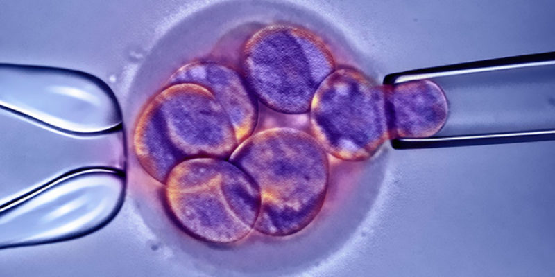 Diagnóstico Genético Preimplantacional DGP