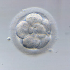 Dos años de lista de espera para una FIV en el hospital público de Sevilla