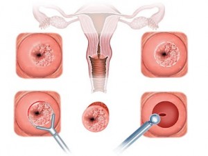 El 75% de los embriones de mujeres de más de 38 años presentan alteraciones