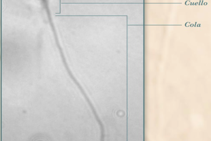 El Espermatozoide humano visto en 1000 aumentos