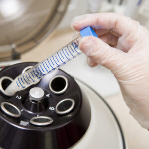 El Vaticano cancela el III Congreso Internacional sobre la Investigación Responsable en Células Madre