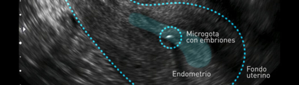 El útero mueve los embriones para que se implanten correctamente