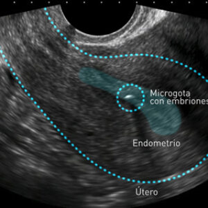 El útero mueve los embriones para que se implanten correctamente