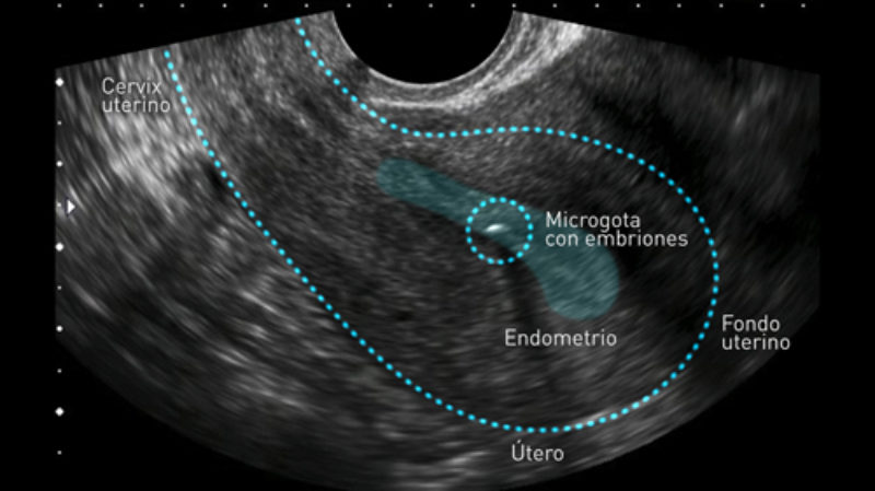 El útero mueve los embriones para que se implanten correctamente