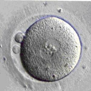 El “negocio” de óvulos y espermatozoides