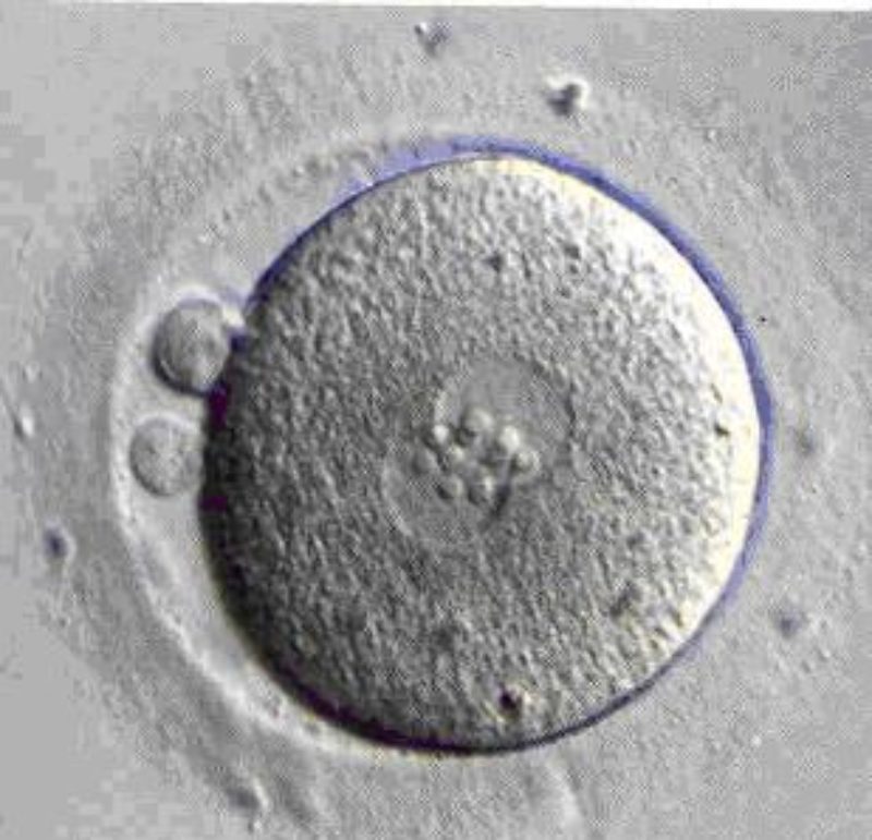El “negocio” de óvulos y espermatozoides