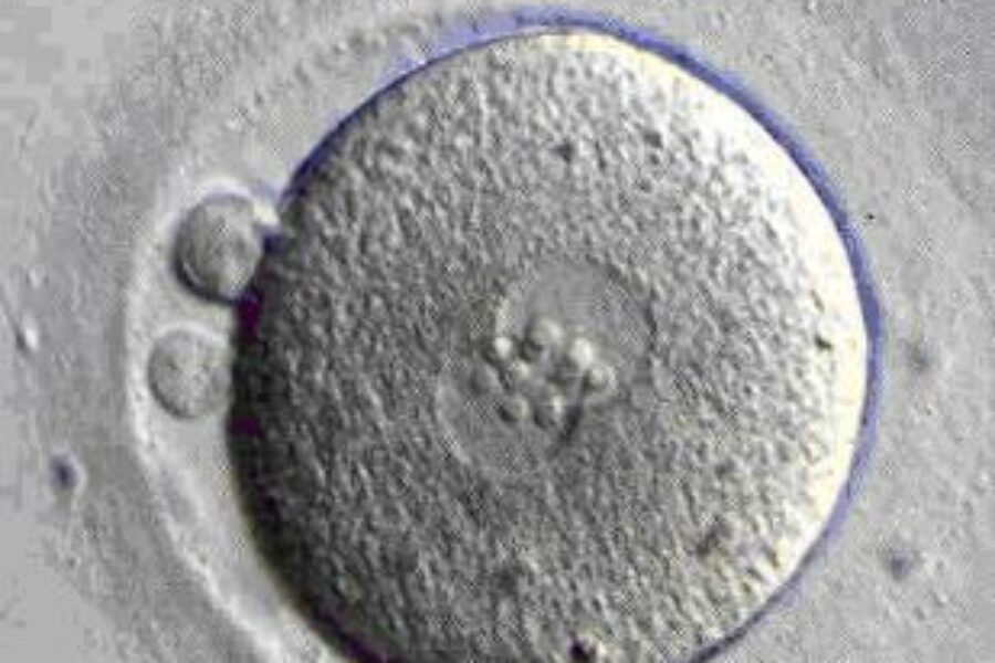 El “negocio” de óvulos y espermatozoides