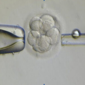 El equipo IMFER evita anomalías en el futuro bebe gracias al Diagnóstico Genético Preimplantacional