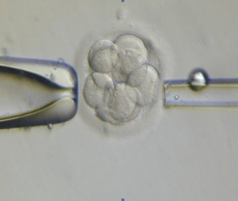 El equipo IMFER evita anomalías en el futuro bebe gracias al Diagnóstico Genético Preimplantacional