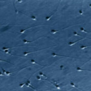El estudio dinámico del ADN del semen aumenta el éxito de los tratamientos