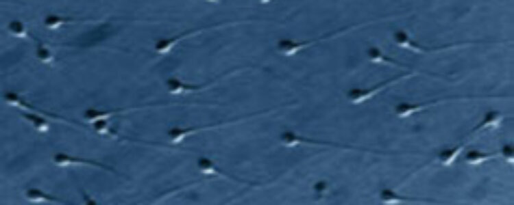 El estudio dinámico del ADN del semen aumenta el éxito de los tratamientos