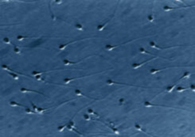 El estudio dinámico del ADN del semen aumenta el éxito de los tratamientos